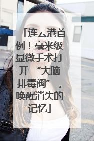连云港首例！毫米级显微手术打开 “大脑排毒阀”，唤醒消失的记忆